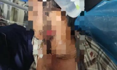 रायपुर में रोड रेज ने लिया हिंसक रूप: युवक पर चाकू से जानलेवा हमला, आरोपी हिरासत में ...